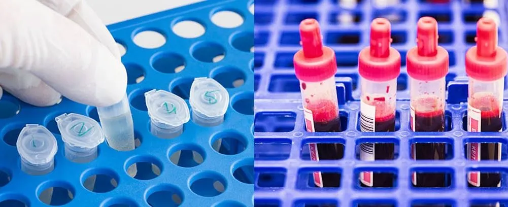 plastic test tube rack for 15ml tubes application