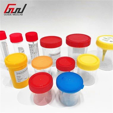 Siydik namunasi uchun idish kubogi 250 ml